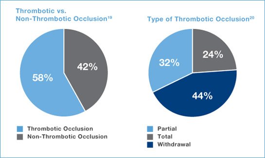 Thrombotic occlusion